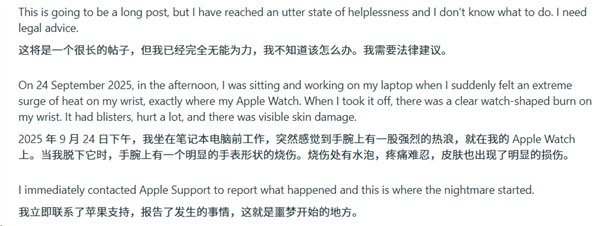 苹果Apple Watch灼伤手腕痕迹