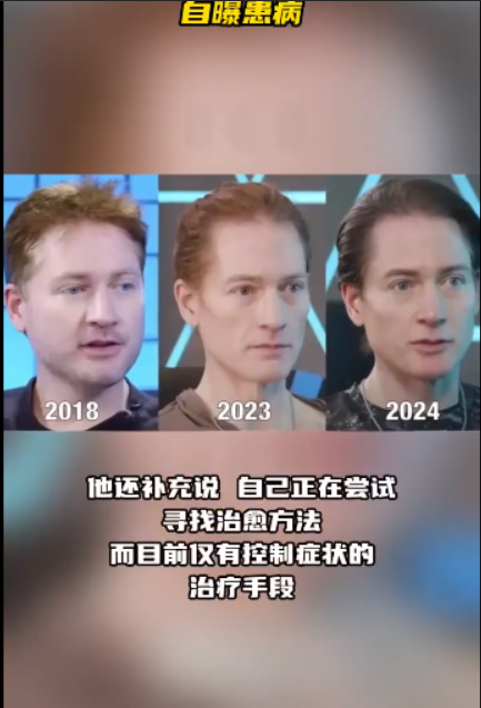 美国亿万富翁为求生换血失败，转而用基因克隆自己