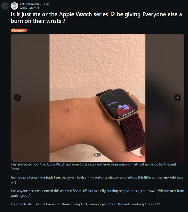 苹果Apple Watch S12被曝引发皮肤不适！有用户佩戴后手腕发红、出现灼烧感